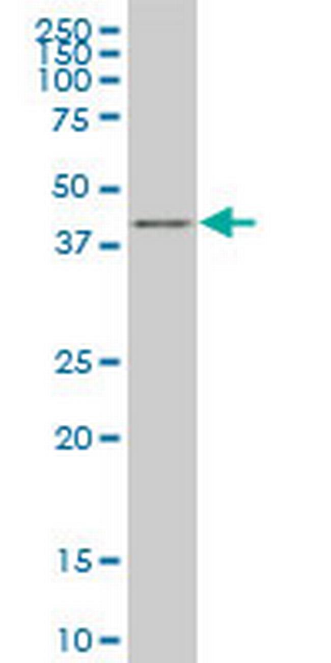 KLF1 Antibody in Western Blot (WB)