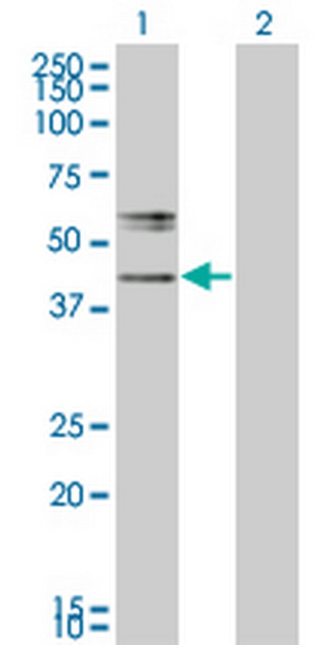 B3GNT2 Antibody in Western Blot (WB)