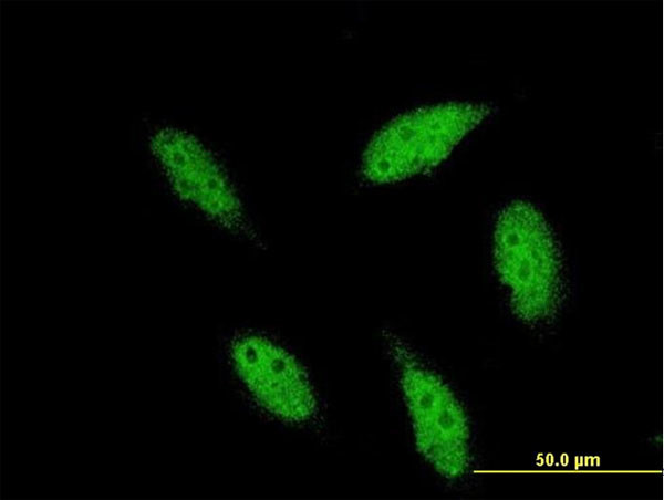 TBR1 Antibody in Immunocytochemistry (ICC/IF)