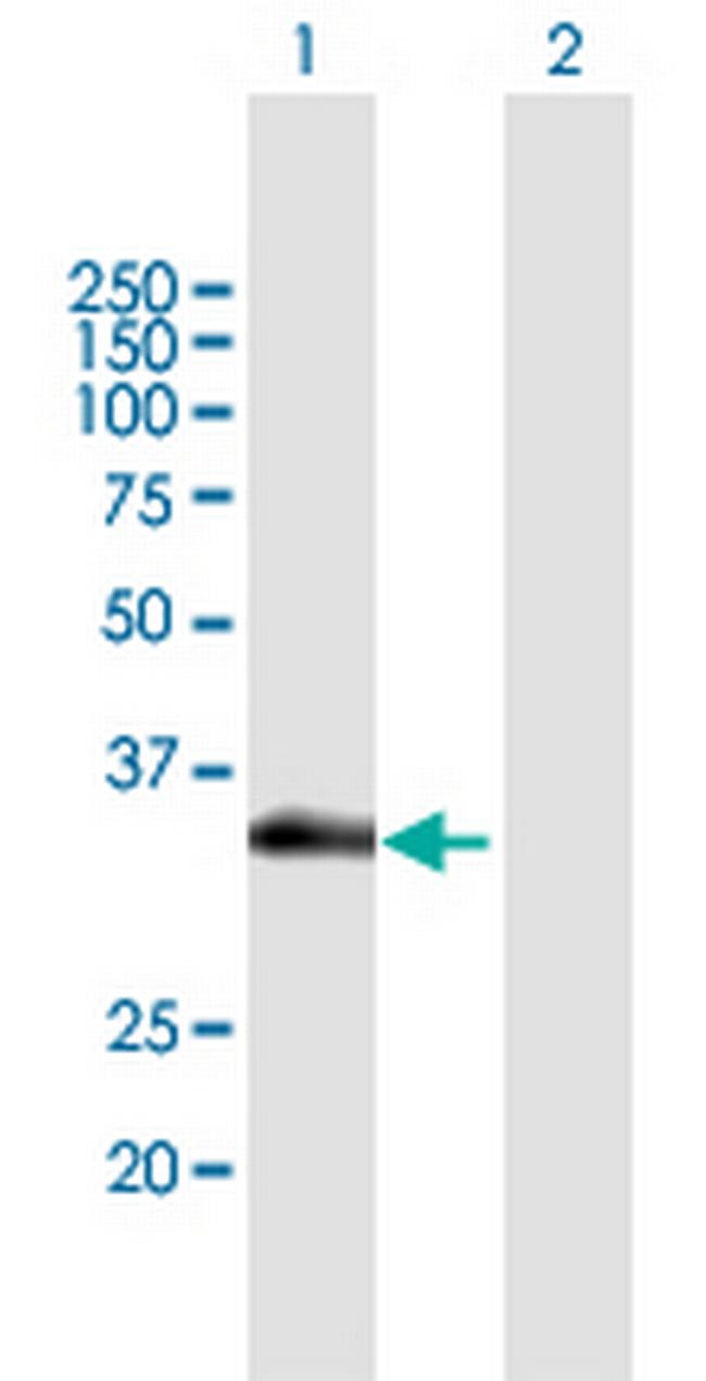 SLC12A7 Antibody in Western Blot (WB)
