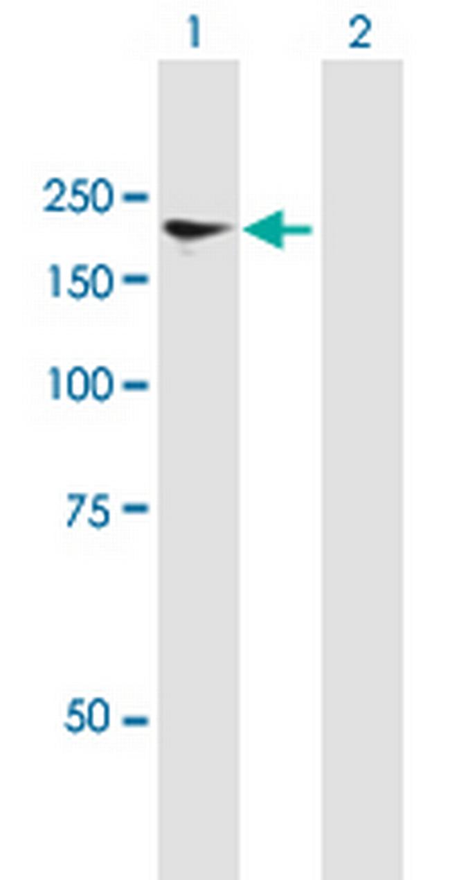 NFAT5 Antibody in Western Blot (WB)