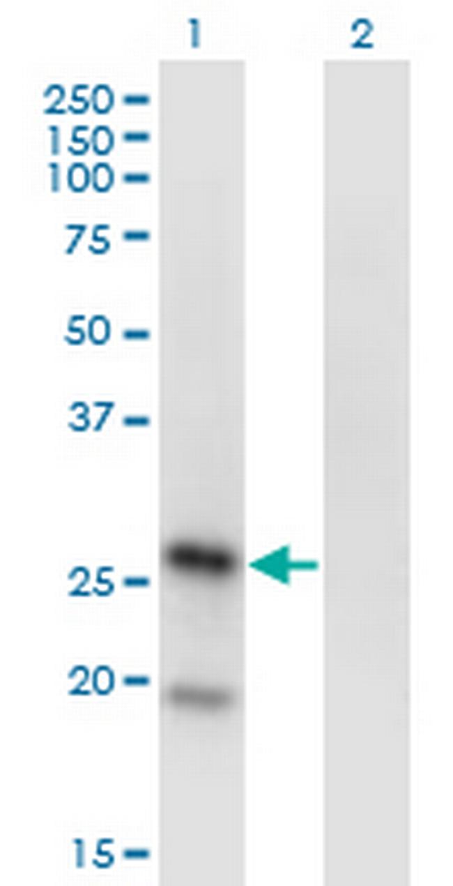 KLRA1 Antibody in Western Blot (WB)