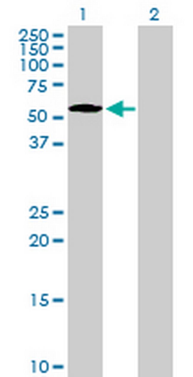 NUP50 Antibody in Western Blot (WB)