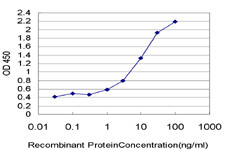 KDM5B Antibody in ELISA (ELISA)