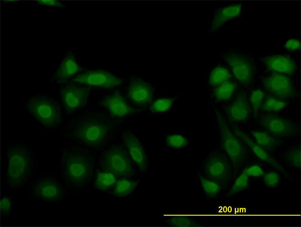 KDM5B Antibody in Immunocytochemistry (ICC/IF)