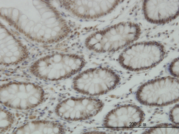 KDM5B Antibody in Immunohistochemistry (Paraffin) (IHC (P))