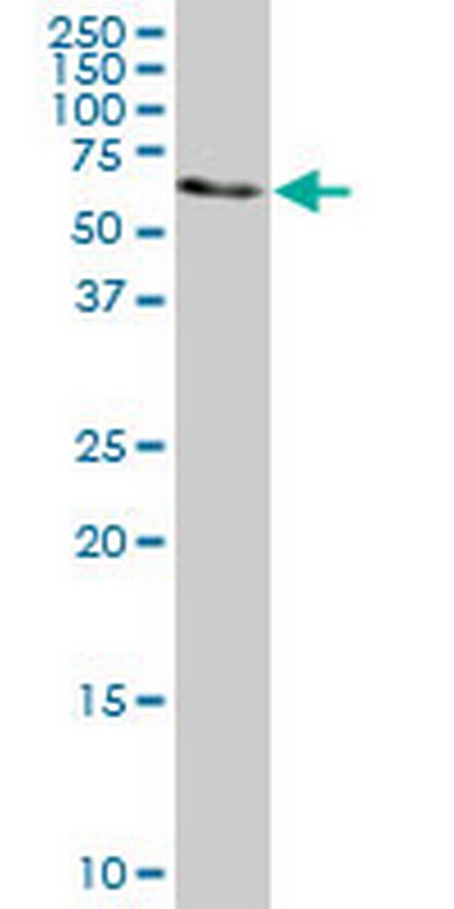 AHCYL1 Antibody in Western Blot (WB)