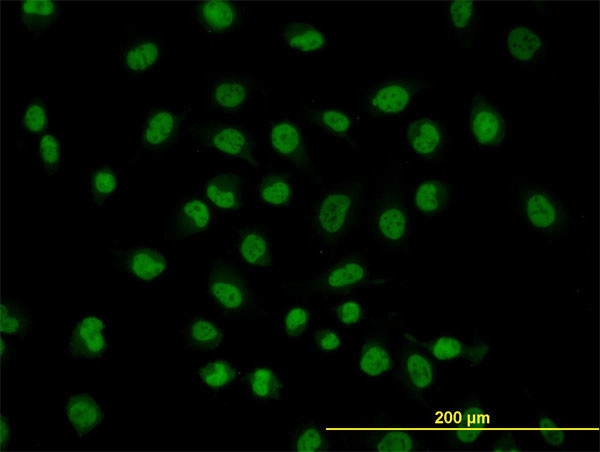 FUSIP1 Antibody in Immunocytochemistry (ICC/IF)