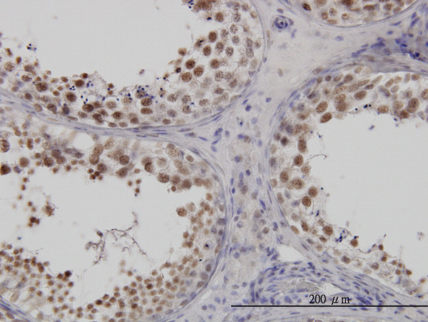 FUSIP1 Antibody in Immunohistochemistry (Paraffin) (IHC (P))