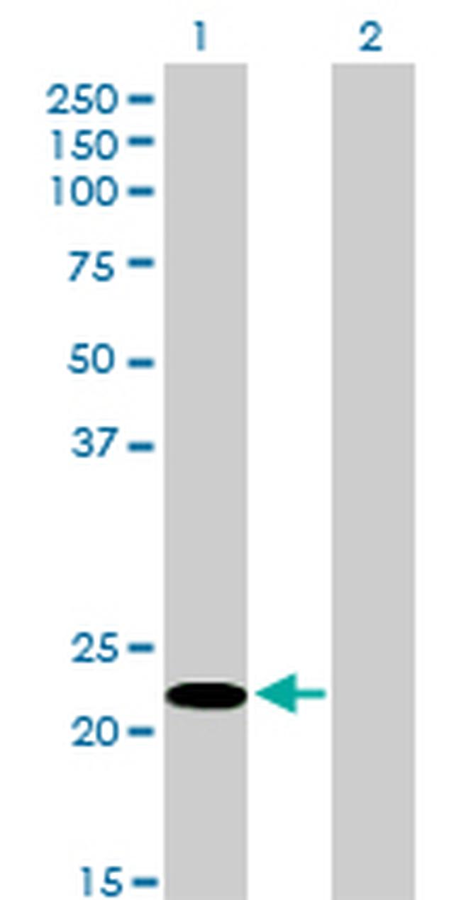 FUSIP1 Antibody in Western Blot (WB)