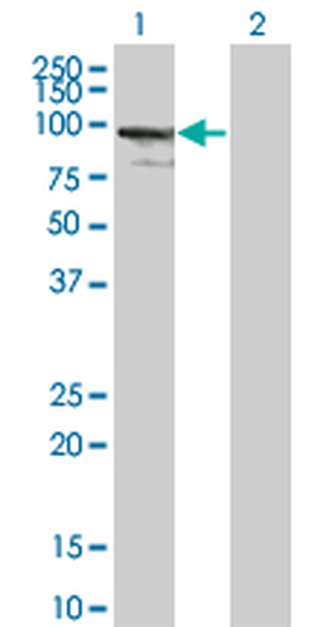 ZNF274 Antibody in Western Blot (WB)