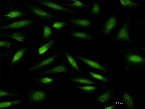 ZNF274 Antibody in Immunocytochemistry (ICC/IF)