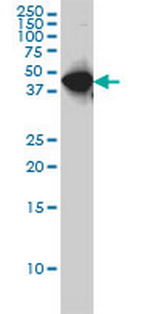 WDR4 Antibody in Western Blot (WB)