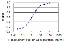 SEPT9 Antibody in ELISA (ELISA)