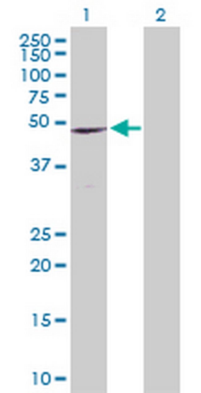 CCR9 Antibody in Western Blot (WB)