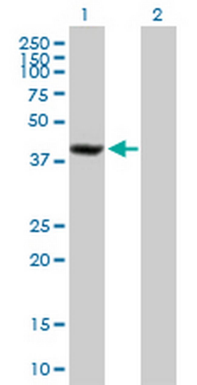 SDCCAG8 Antibody in Western Blot (WB)