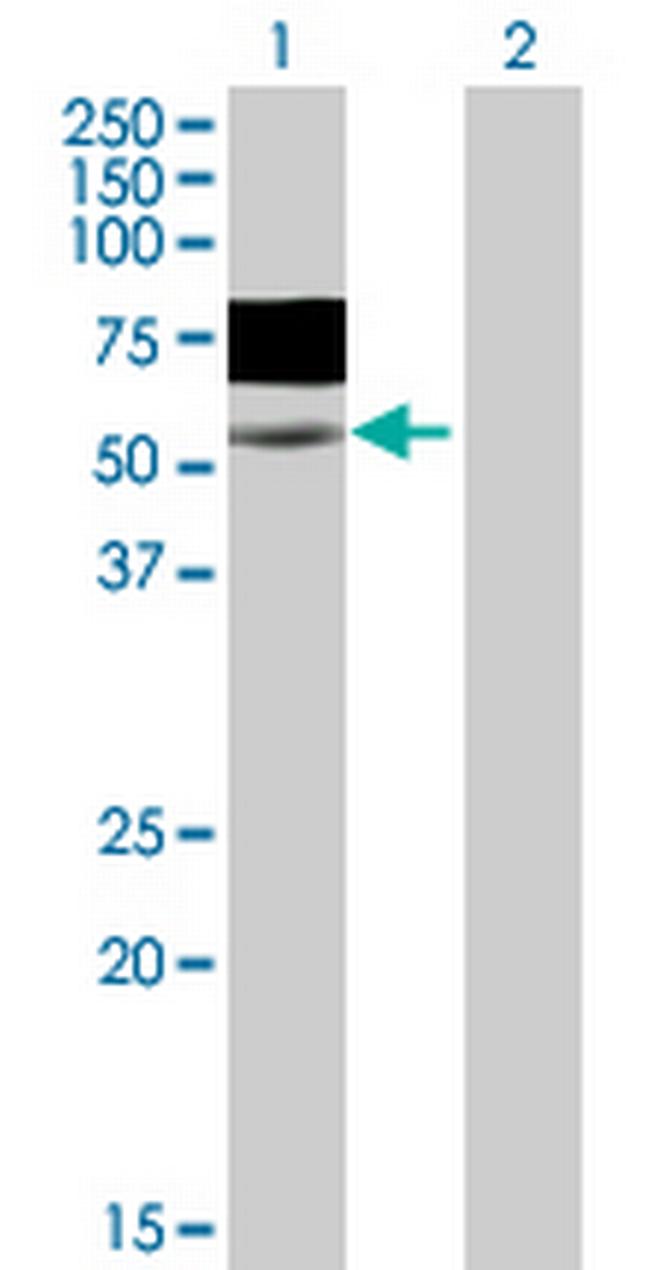 WASF3 Antibody in Western Blot (WB)