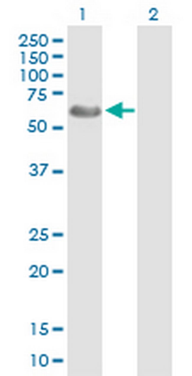 WASF3 Antibody in Western Blot (WB)