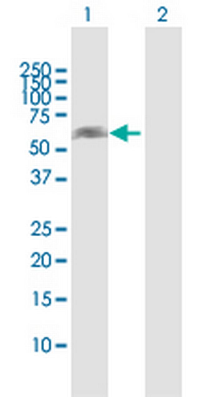 NOXA1 Antibody in Western Blot (WB)