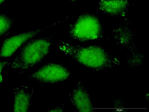 CCL27 Antibody in Immunocytochemistry (ICC/IF)