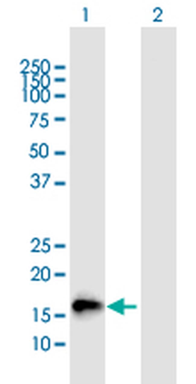 NMU Antibody in Western Blot (WB)