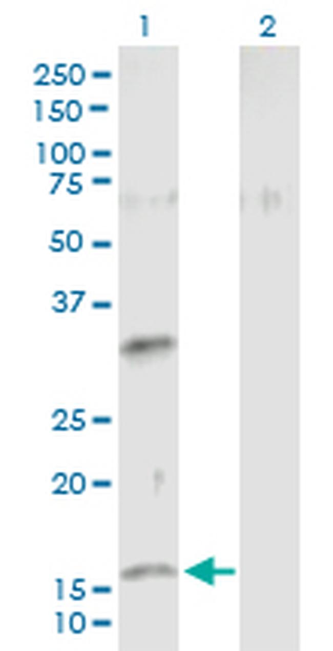 NMU Antibody in Western Blot (WB)