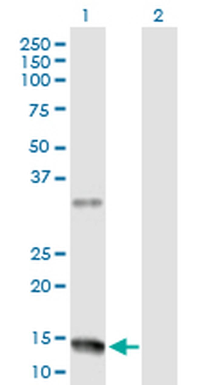 NMU Antibody in Western Blot (WB)