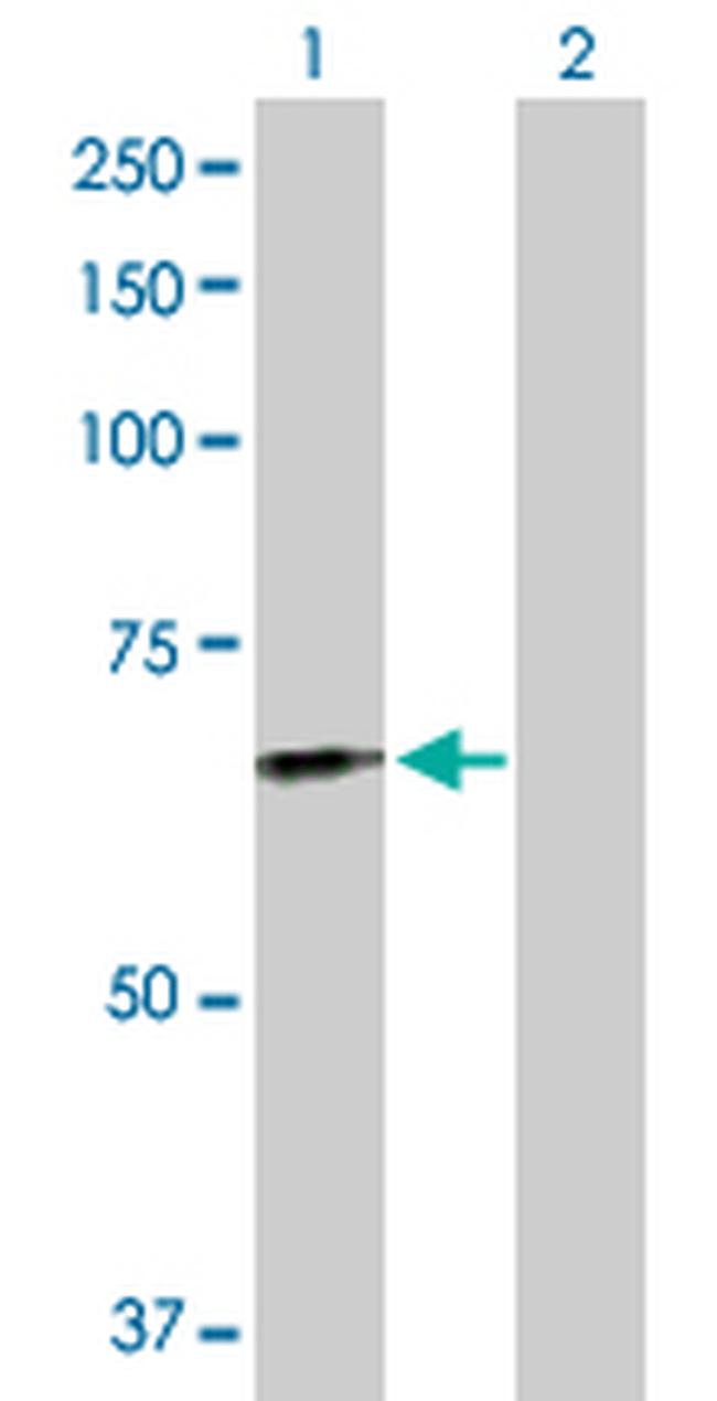 FGL2 Antibody in Western Blot (WB)