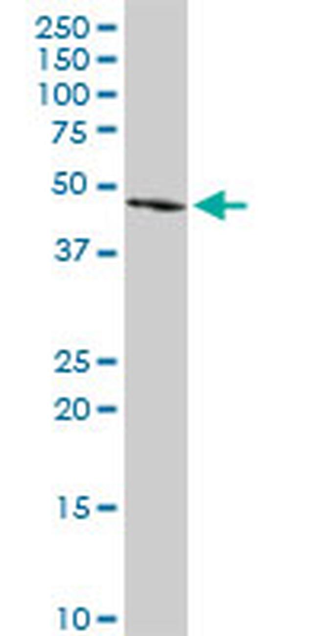 FGL2 Antibody in Western Blot (WB)