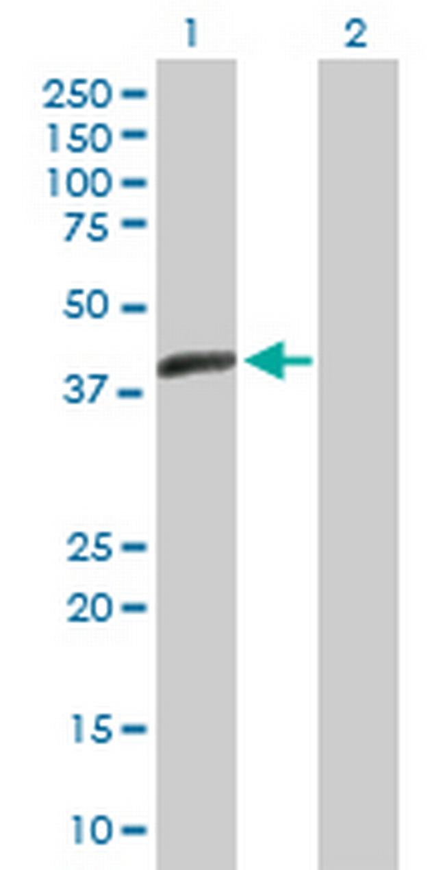 ACTL7B Antibody in Western Blot (WB)