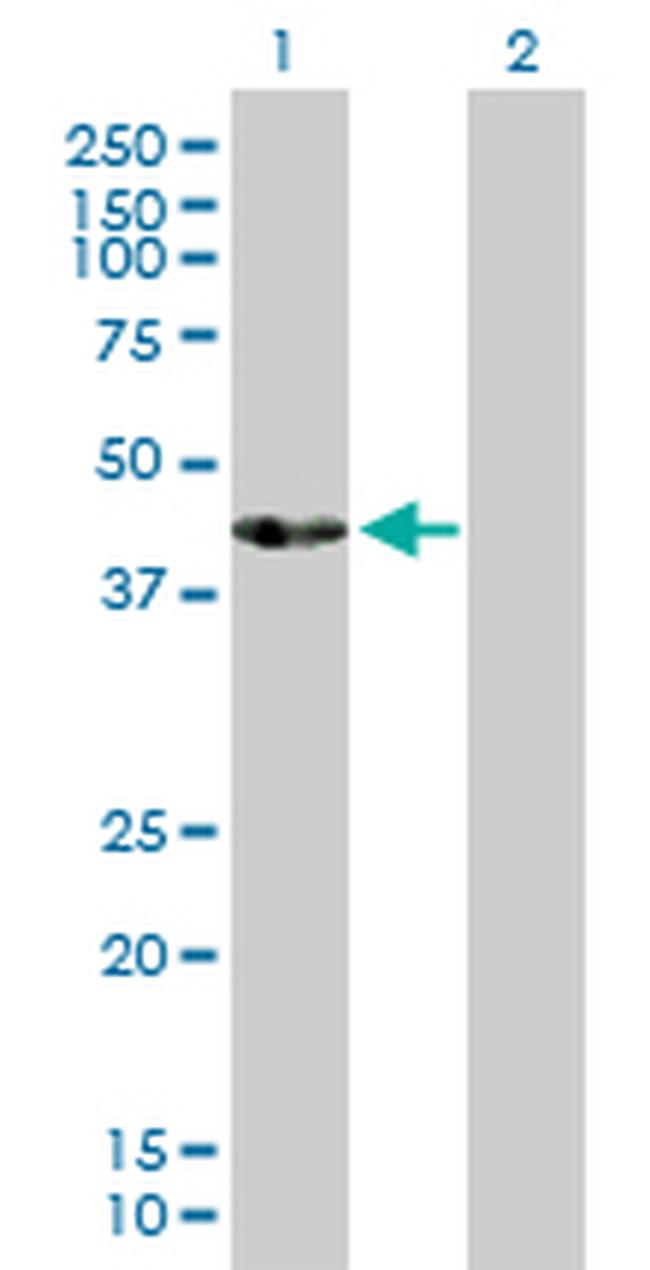 ACTL7B Antibody in Western Blot (WB)