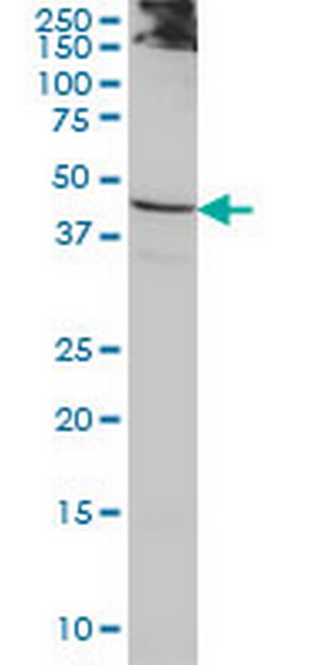 ACTL7B Antibody in Western Blot (WB)