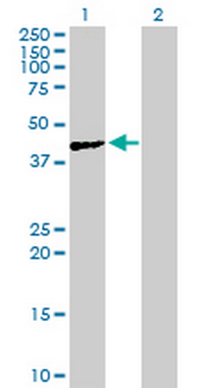 ACTL7A Antibody in Western Blot (WB)