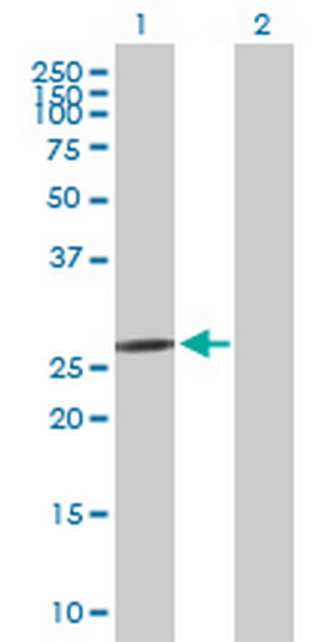 C1QL1 Antibody in Western Blot (WB)