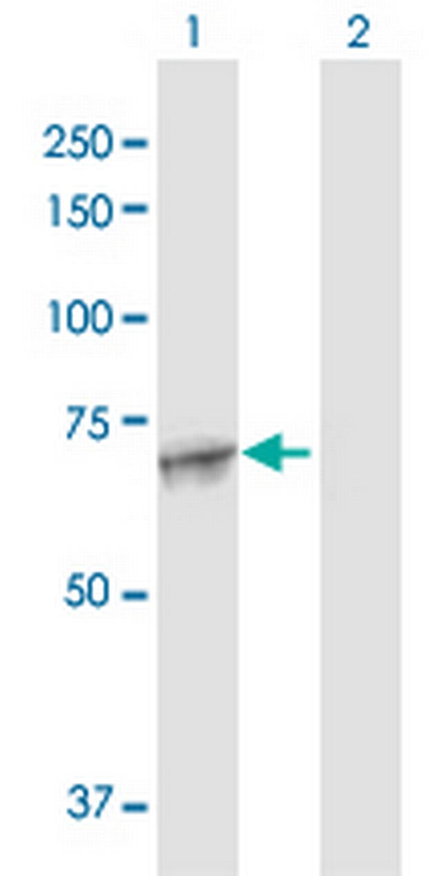 MAN1A2 Antibody in Western Blot (WB)