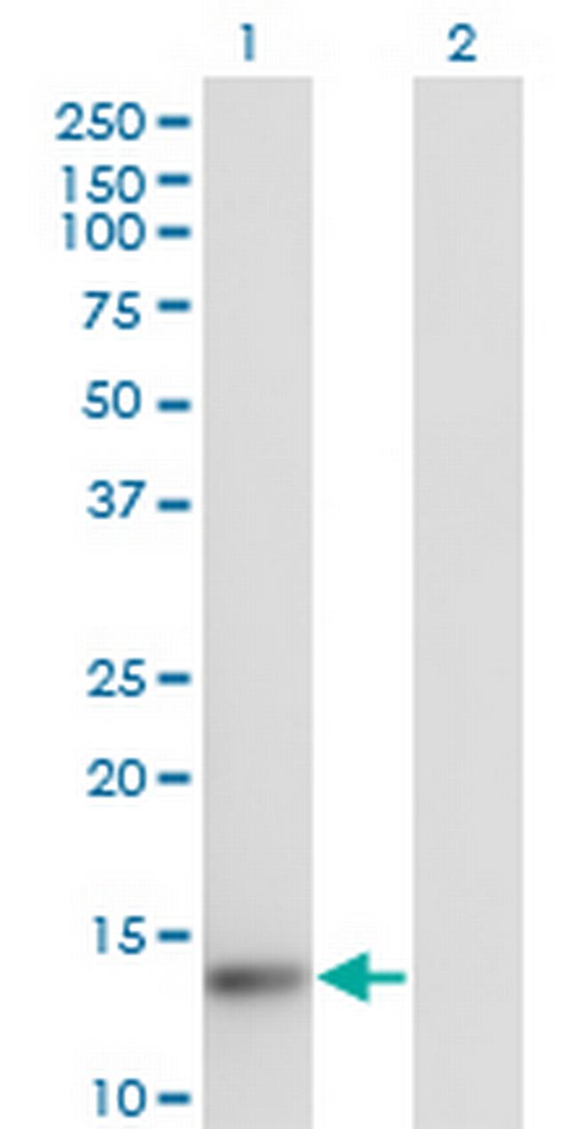 TXNL4A Antibody in Western Blot (WB)