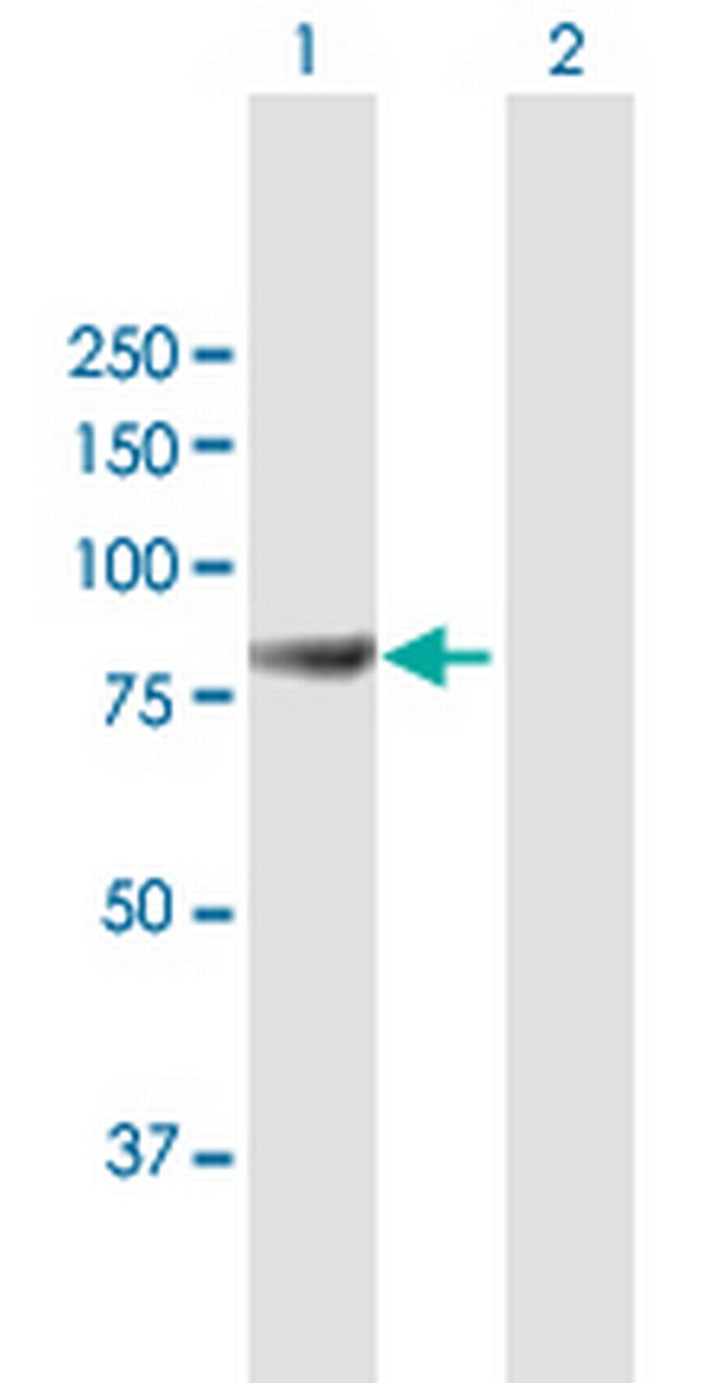 MAGED2 Antibody in Western Blot (WB)