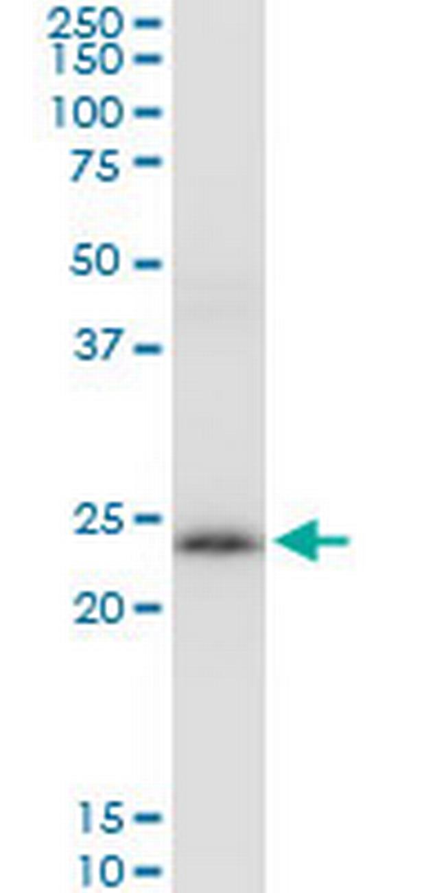 PRDX3 Antibody in Western Blot (WB)