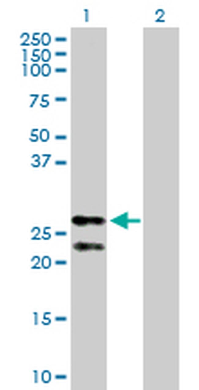 PRDX3 Antibody in Western Blot (WB)