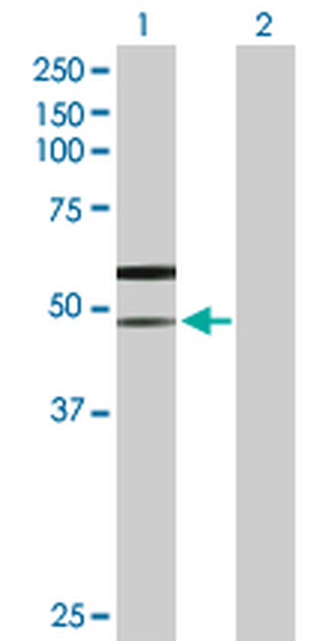 SLC38A3 Antibody in Western Blot (WB)