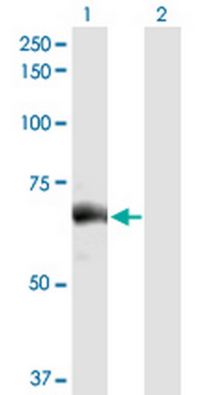 SLC27A5 Antibody in Western Blot (WB)