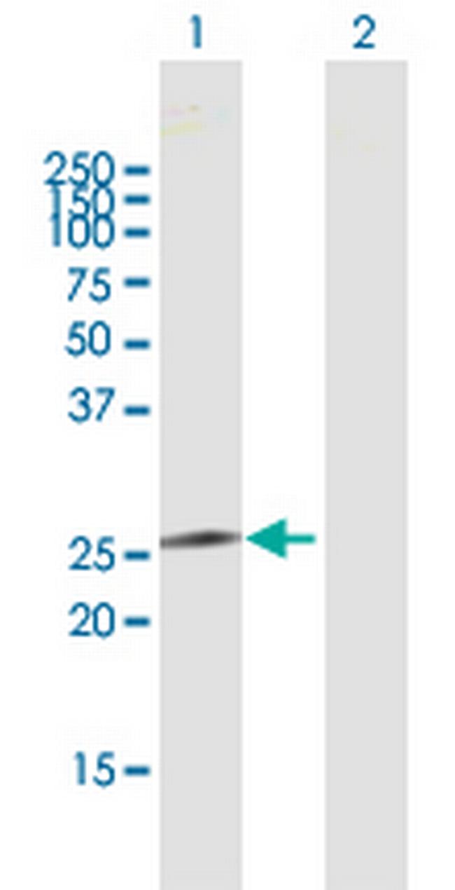 IL24 Antibody in Western Blot (WB)