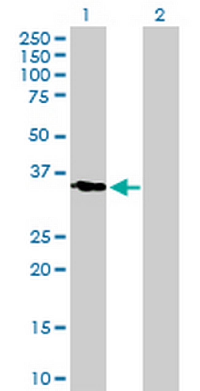 KLK11 Antibody in Western Blot (WB)