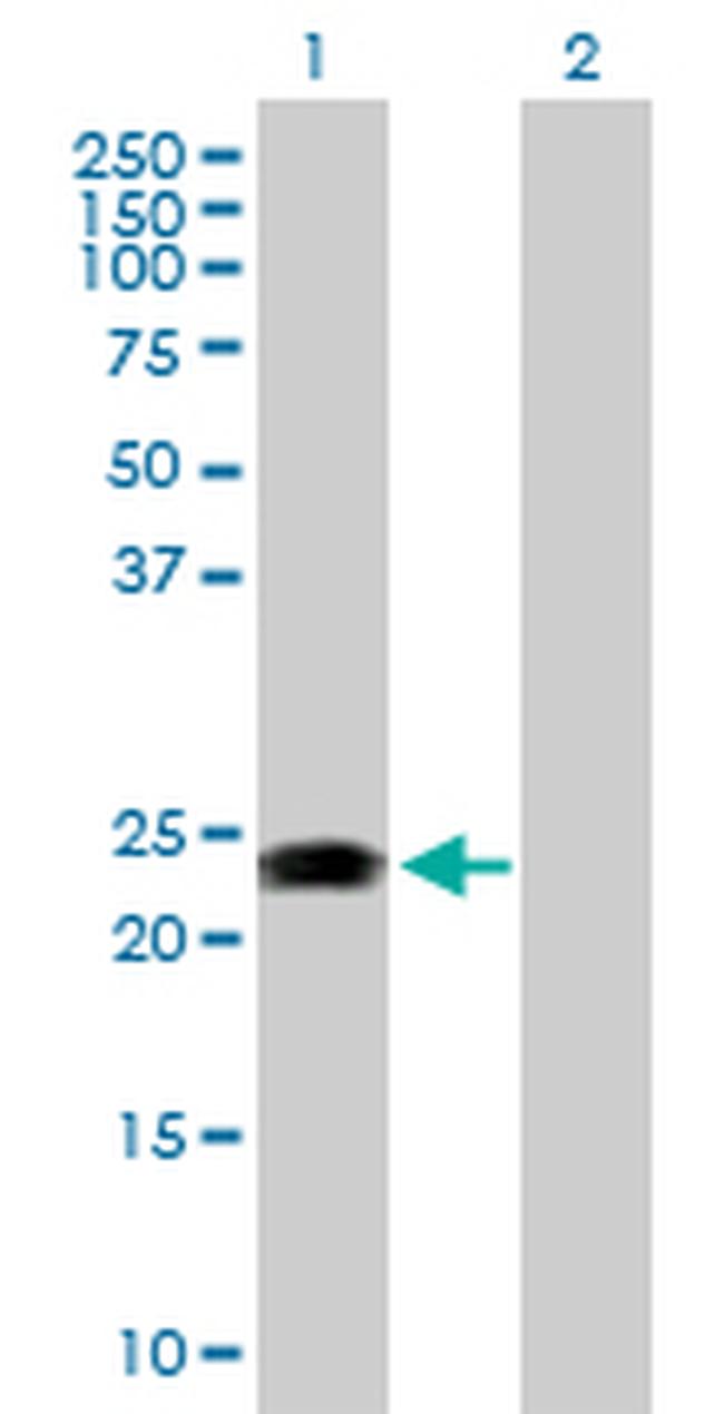 RAB31 Antibody in Western Blot (WB)