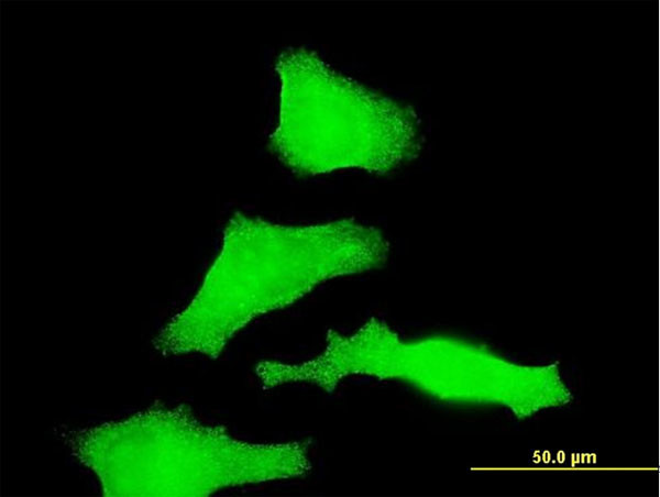 RAB31 Antibody in Immunocytochemistry (ICC/IF)