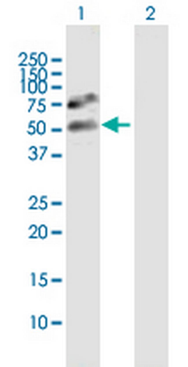 GTF2A1L Antibody in Western Blot (WB)