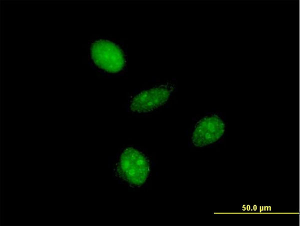 ALF Antibody in Immunocytochemistry (ICC/IF)