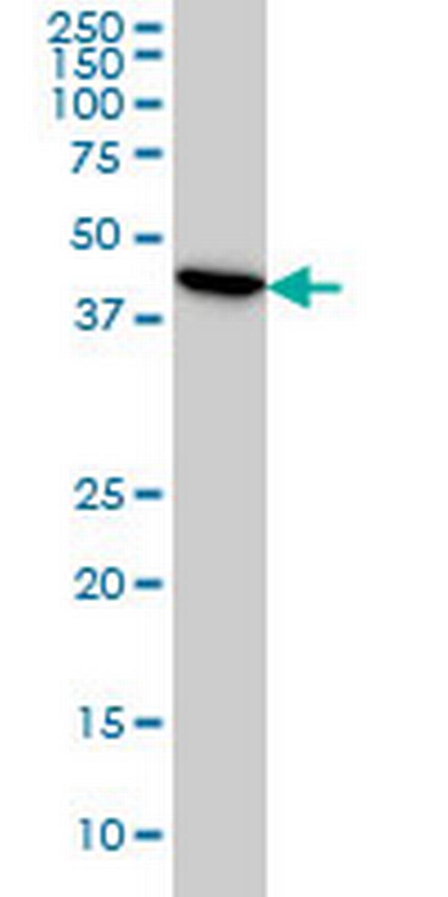 ADRM1 Antibody in Western Blot (WB)