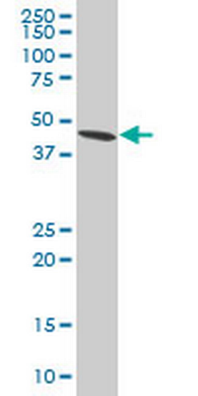 ADRM1 Antibody in Western Blot (WB)