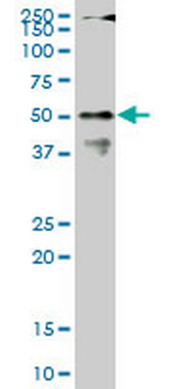 CPSF6 Antibody in Western Blot (WB)